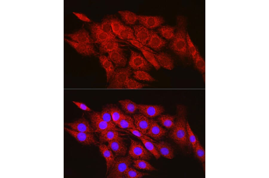 Immunofluorescence - Anti-CPT2 Antibody (A91088) - Antibodies.com