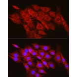 Immunofluorescence - Anti-CPT2 Antibody (A91088) - Antibodies.com