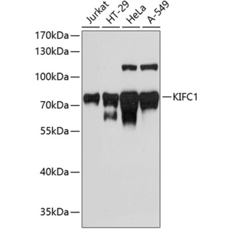 Western Blot - Anti-KIFC1 Antibody (A91089) - Antibodies.com