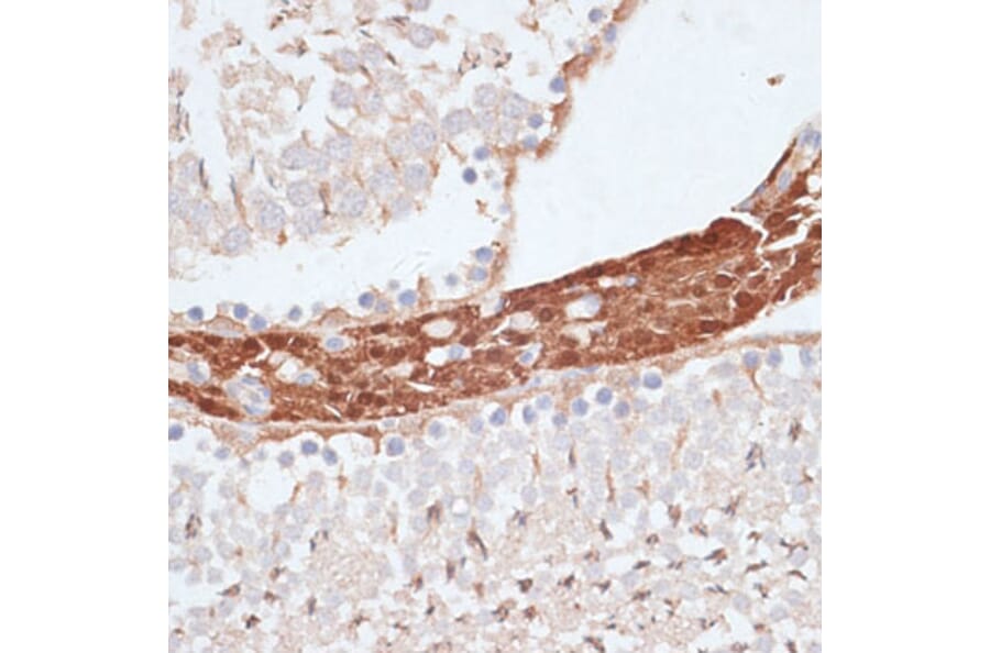 Immunohistochemistry - Anti-KIFC1 Antibody (A91089) - Antibodies.com