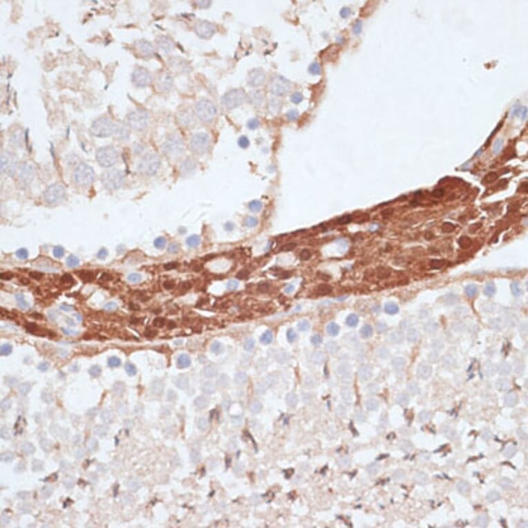 Immunohistochemistry - Anti-KIFC1 Antibody (A91089) - Antibodies.com