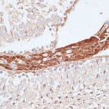 Immunohistochemistry - Anti-KIFC1 Antibody (A91089) - Antibodies.com