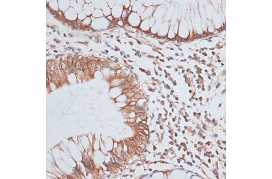 Immunohistochemistry - Anti-KIFC1 Antibody (A91089) - Antibodies.com
