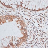 Immunohistochemistry - Anti-KIFC1 Antibody (A91089) - Antibodies.com
