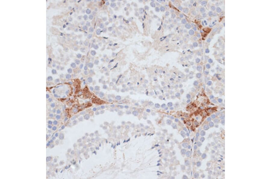 Immunohistochemistry - Anti-KIFC1 Antibody (A91089) - Antibodies.com
