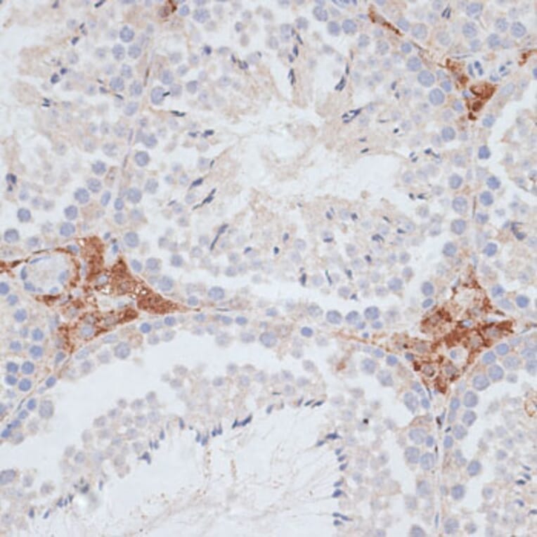 Immunohistochemistry - Anti-KIFC1 Antibody (A91089) - Antibodies.com