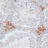 Immunohistochemistry - Anti-KIFC1 Antibody (A91089) - Antibodies.com