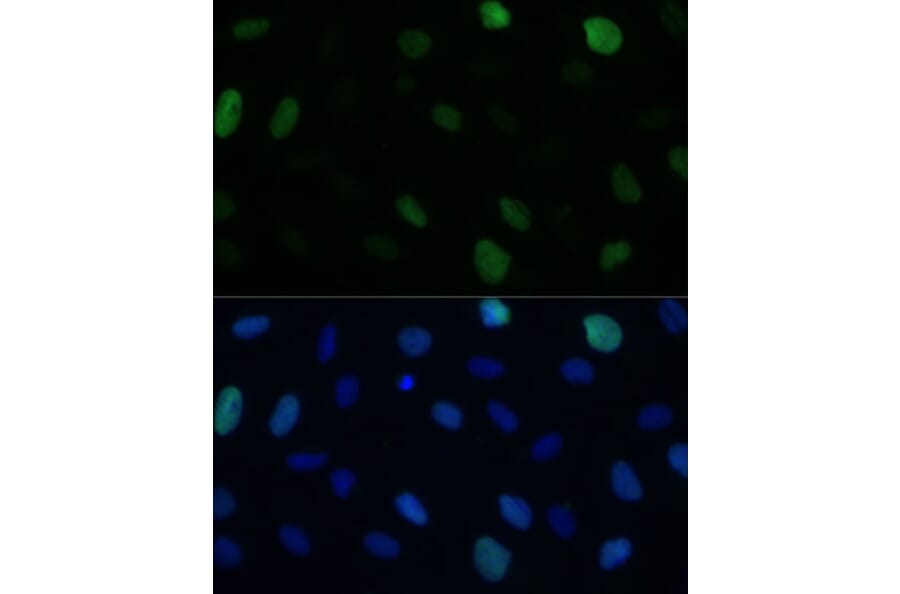 Immunofluorescence - Anti-KIFC1 Antibody (A91089) - Antibodies.com