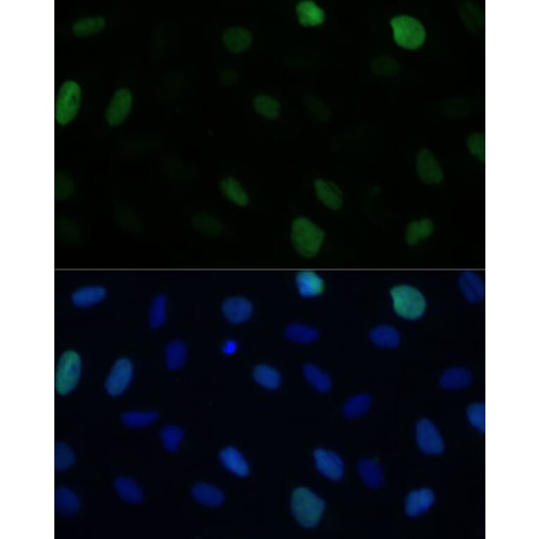 Immunofluorescence - Anti-KIFC1 Antibody (A91089) - Antibodies.com