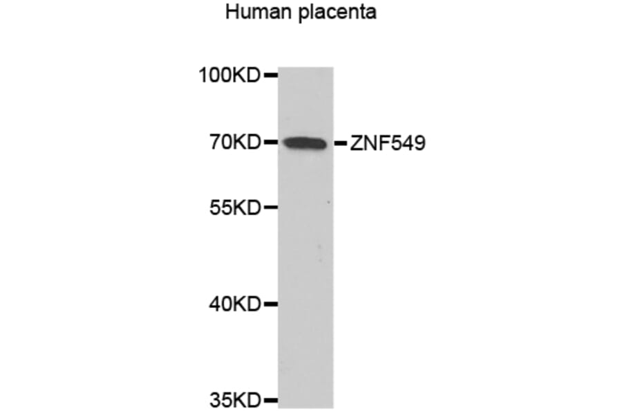 Western Blot - Anti-ZNF549 Antibody (A14979) - Antibodies.com