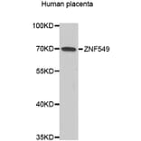 Western Blot - Anti-ZNF549 Antibody (A14979) - Antibodies.com