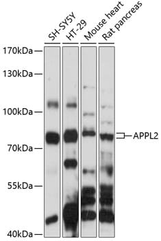Western blot analysis of extracts of various cell lines, using Anti-APPL2 Antibody (A14590) at 1:1,000 dilution.
Secondary antibody: Goat Anti-Rabbit IgG (H+L) (HRP) (AS014) at 1:10,000 dilution.
Lysates / proteins: 25µg per lane.
Blocking buffer: 3% non-fat dry milk in TBST.
Detection: ECL Basic Kit (RM00020).
Exposure time: 90s.