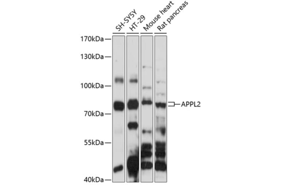 Western Blot - Anti-DIP13B/APPL2 Antibody (A91091) - Antibodies.com