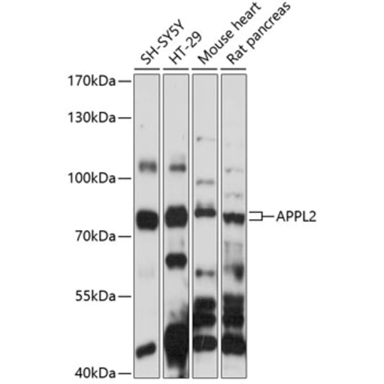 Western Blot - Anti-DIP13B/APPL2 Antibody (A91091) - Antibodies.com