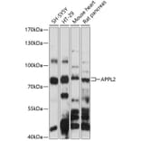 Western Blot - Anti-DIP13B/APPL2 Antibody (A91091) - Antibodies.com