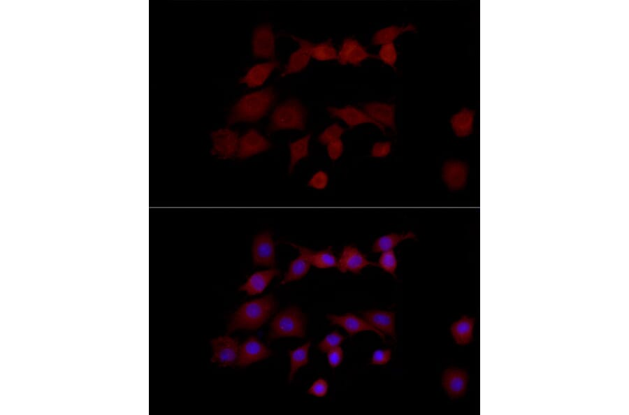 Immunofluorescence - Anti-PNGase Antibody (A91092) - Antibodies.com