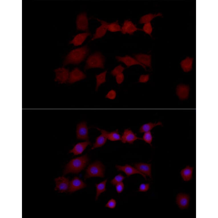 Immunofluorescence - Anti-PNGase Antibody (A91092) - Antibodies.com