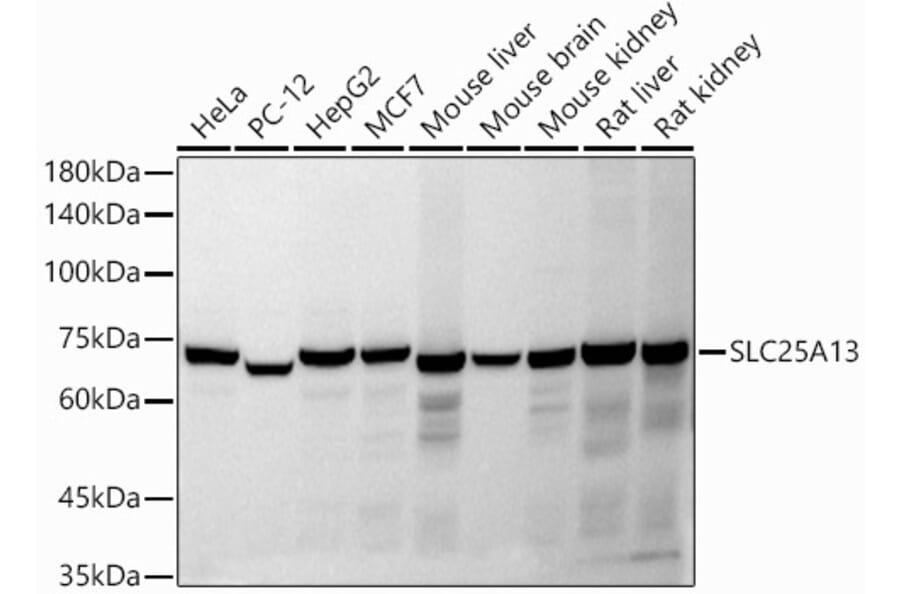 Western Blot - Anti-SLC25A13/Citrin Antibody (A91093) - Antibodies.com