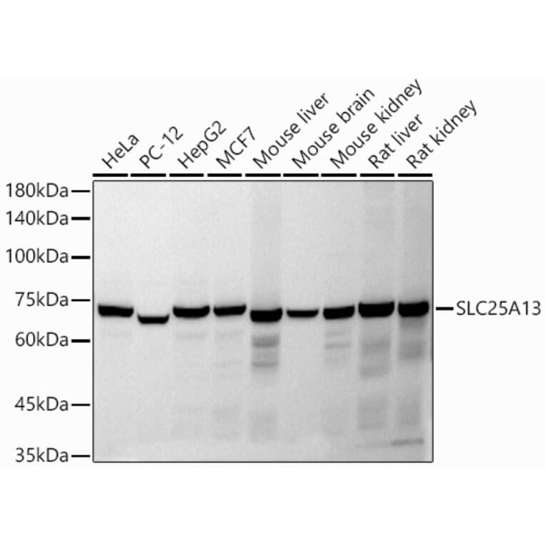 Western Blot - Anti-SLC25A13/Citrin Antibody (A91093) - Antibodies.com