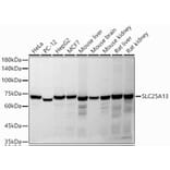 Western Blot - Anti-SLC25A13/Citrin Antibody (A91093) - Antibodies.com