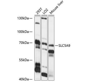 Western Blot - Anti-SLC5A9 Antibody (A91094) - Antibodies.com