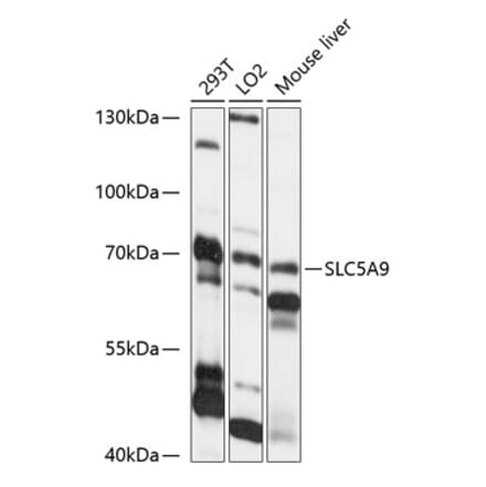 Western Blot - Anti-SLC5A9 Antibody (A91094) - Antibodies.com