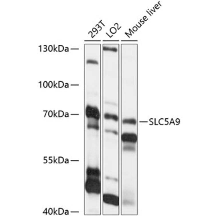 Western Blot - Anti-SLC5A9 Antibody (A91094) - Antibodies.com