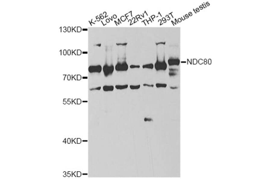 Western Blot - Anti-NDC80 Antibody (A14102) - Antibodies.com