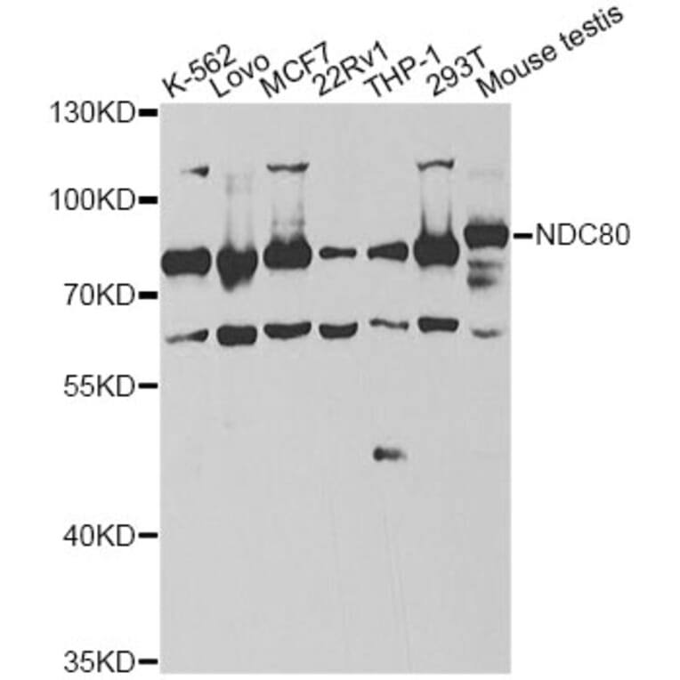 Western Blot - Anti-NDC80 Antibody (A14102) - Antibodies.com