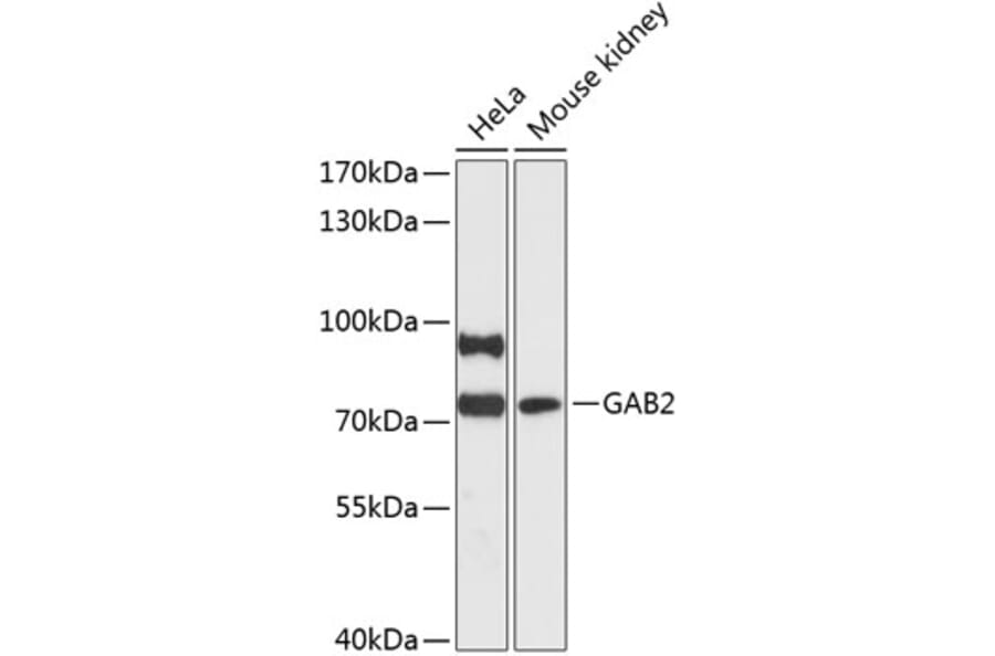 Western Blot - Anti-GAB2 Antibody (A91097) - Antibodies.com