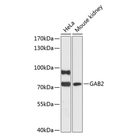 Western Blot - Anti-GAB2 Antibody (A91097) - Antibodies.com