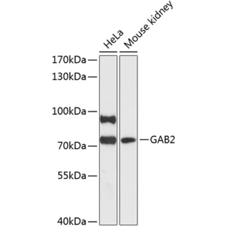 Western Blot - Anti-GAB2 Antibody (A91097) - Antibodies.com