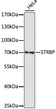 Western blot analysis of extracts of HeLa cells, using Anti-STRBP Antibody (A15169) at 1:1,000 dilution.
Secondary antibody: Goat Anti-Rabbit IgG (H+L) (HRP) (AS014) at 1:10,000 dilution.
Lysates / proteins: 25µg per lane.
Blocking buffer: 3% non-fat dry milk in TBST.
Detection: ECL Basic Kit (RM00020).
Exposure time: 90s.