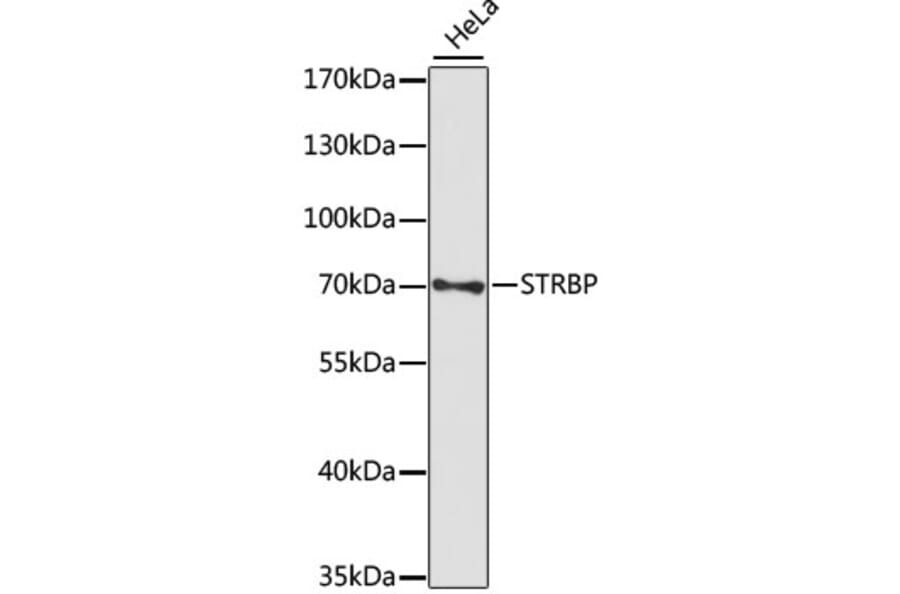 Western Blot - Anti-STRBP Antibody (A91098) - Antibodies.com