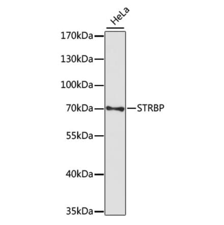 Western Blot - Anti-STRBP Antibody (A91098) - Antibodies.com
