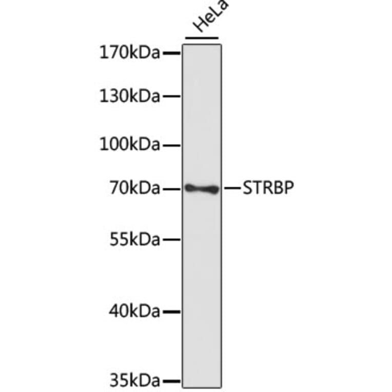 Western Blot - Anti-STRBP Antibody (A91098) - Antibodies.com