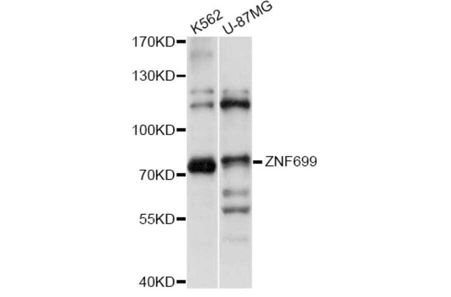 Western Blot - Anti-ZNF699 Antibody (A14466) - Antibodies.com