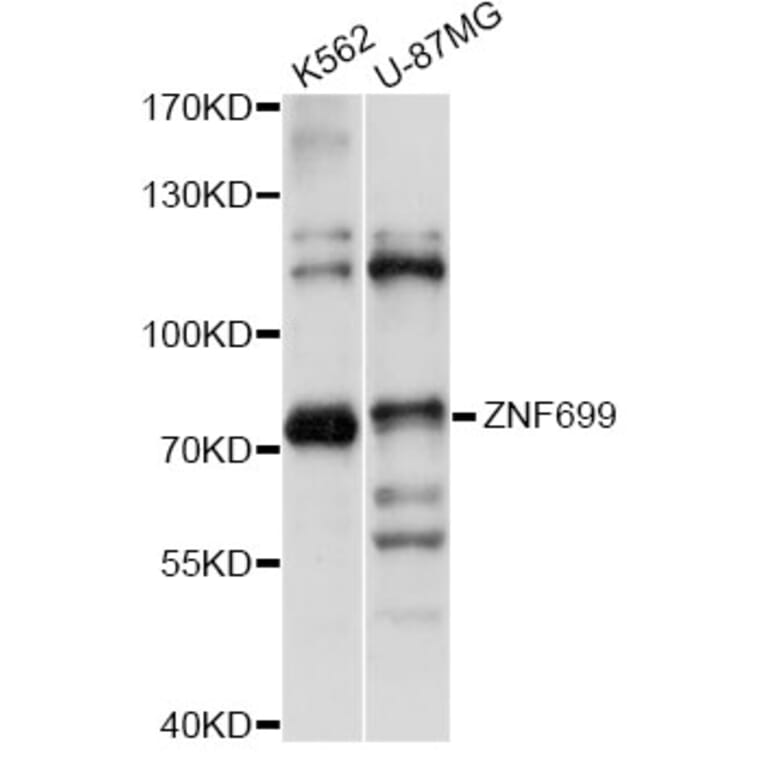 Western Blot - Anti-ZNF699 Antibody (A14466) - Antibodies.com