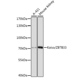 Western Blot - Anti-KAISO Antibody (A91100) - Antibodies.com