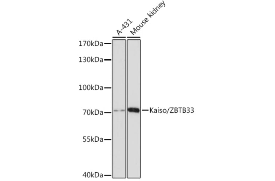 Western Blot - Anti-KAISO Antibody (A91100) - Antibodies.com