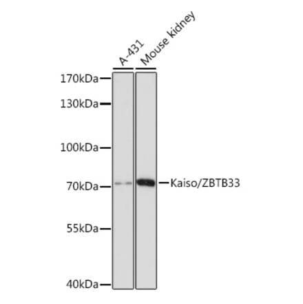 Western Blot - Anti-KAISO Antibody (A91100) - Antibodies.com