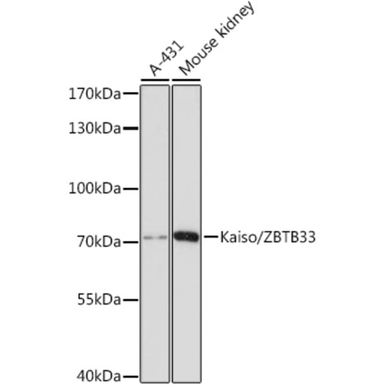 Western Blot - Anti-KAISO Antibody (A91100) - Antibodies.com