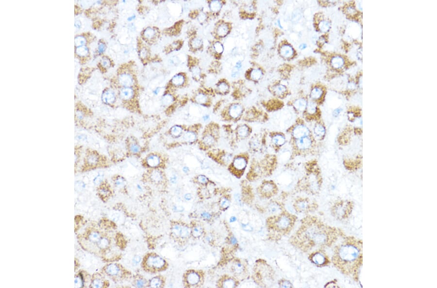 Immunohistochemistry - Anti-KAISO Antibody (A91100) - Antibodies.com