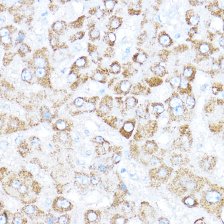 Immunohistochemistry - Anti-KAISO Antibody (A91100) - Antibodies.com