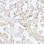 Immunohistochemistry - Anti-KAISO Antibody (A91100) - Antibodies.com