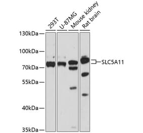 Western Blot - Anti-SLC5A11 Antibody (A91101) - Antibodies.com
