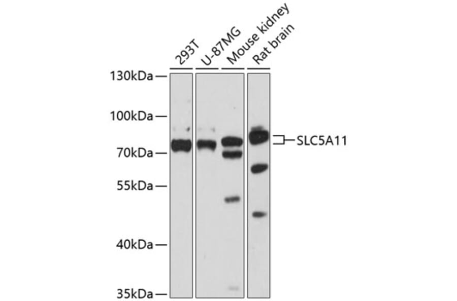 Western Blot - Anti-SLC5A11 Antibody (A91101) - Antibodies.com