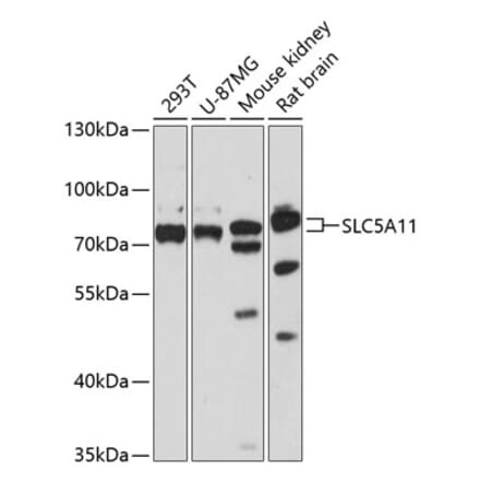 Western Blot - Anti-SLC5A11 Antibody (A91101) - Antibodies.com