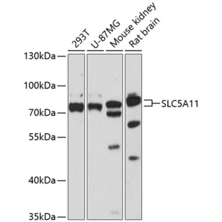 Western Blot - Anti-SLC5A11 Antibody (A91101) - Antibodies.com