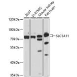 Western Blot - Anti-SLC5A11 Antibody (A91101) - Antibodies.com